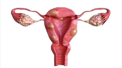 Feature Image