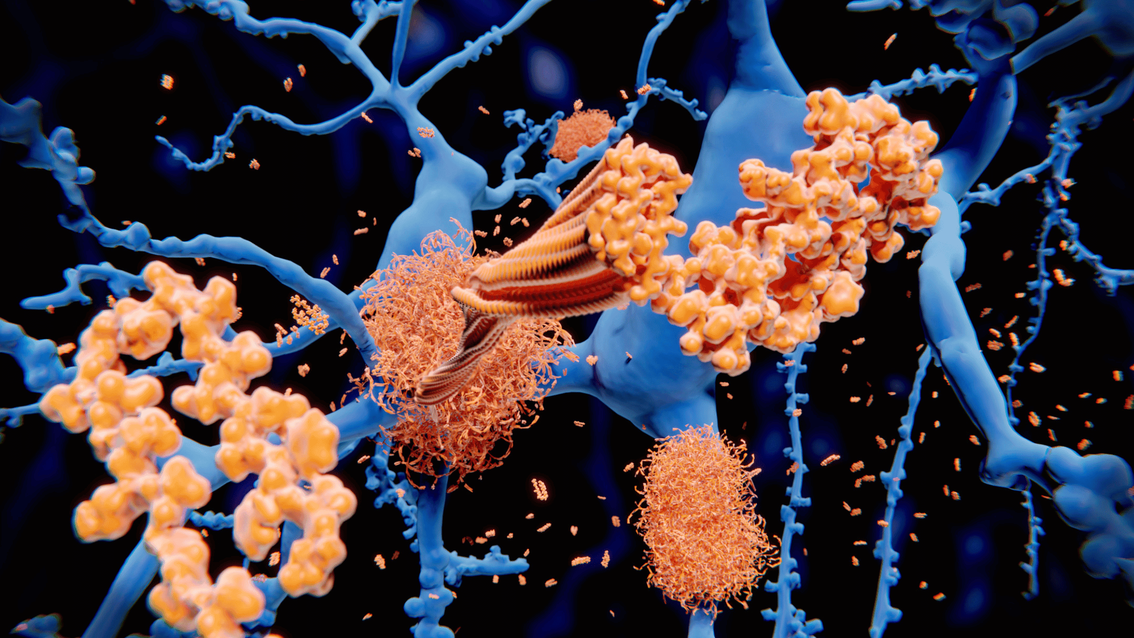 Amyloidosis: A Rare but Serious Disease 