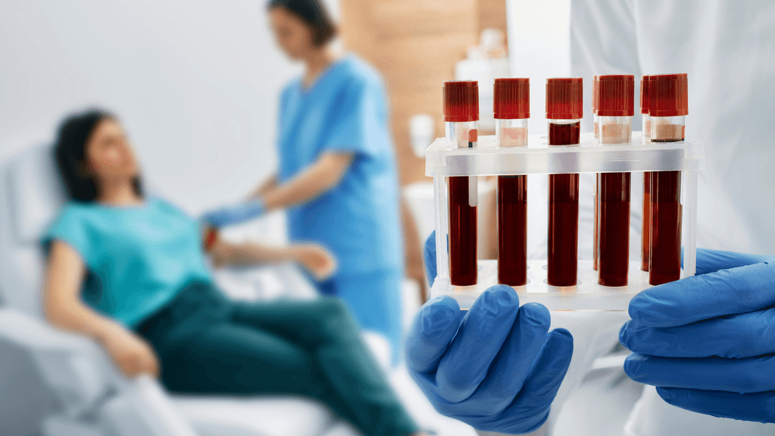 Feature Image