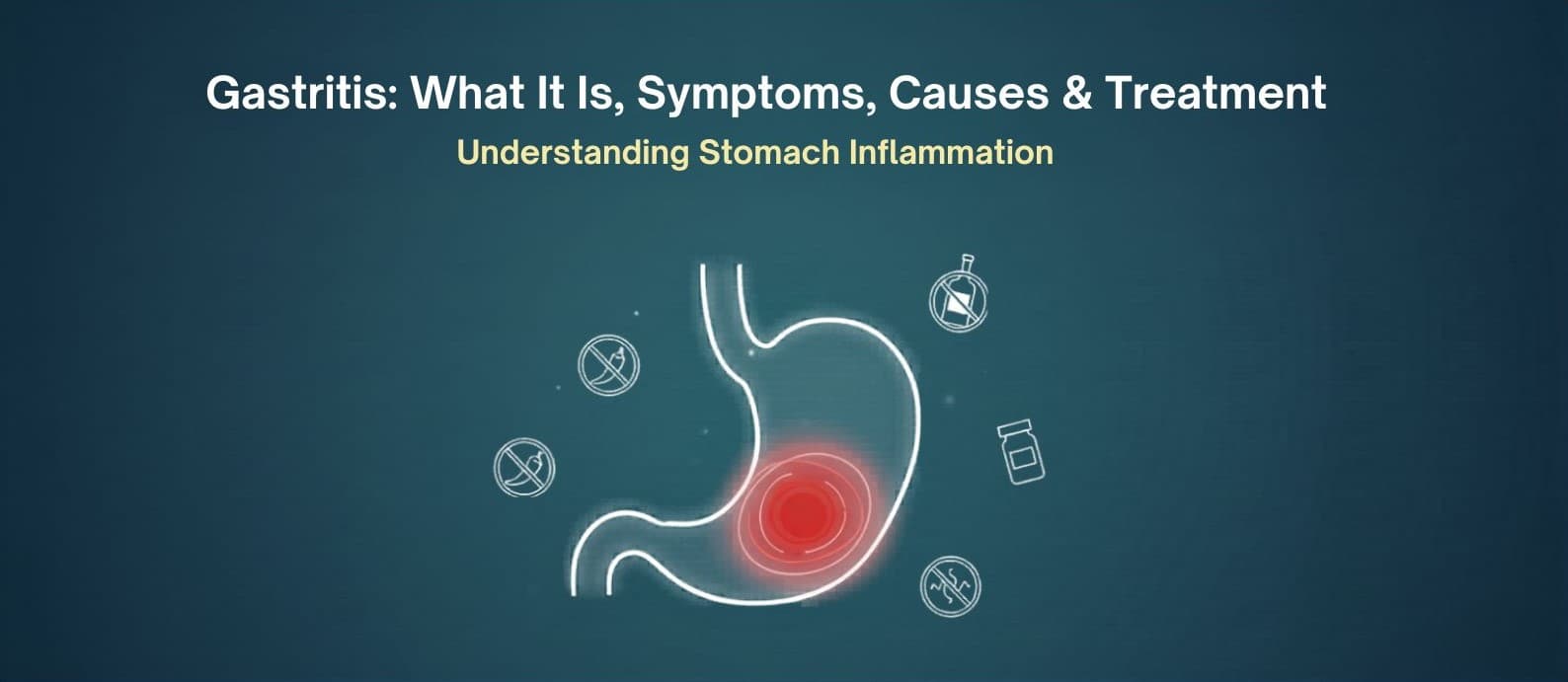 Gastritis: What It Is, Symptoms, Causes & Treatment