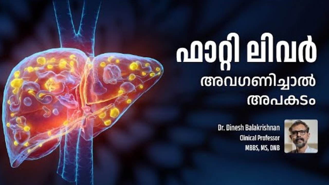 Fatty Liver: When Does It Turn Dangerous?